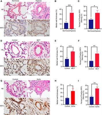 Upregulation of IRF9 Contributes to Pulmonary Artery Smooth Muscle Cell Proliferation During Pulmonary Arterial Hypertension